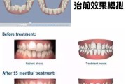 别再瞎听别人吓唬你啦！正畸这事你得先搞懂这些“内幕”