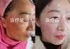 嘿你想开个美容院搞祛斑却不知道该从哪儿下手是吧