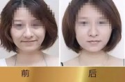 千万别信“一针回春”，俺那旮旯做线雕的遭老罪咯