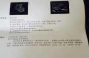 汽车行车记录仪主控芯片NT96658好坏检测实操指南（汽车维修场景适配，新手也能快速排查）